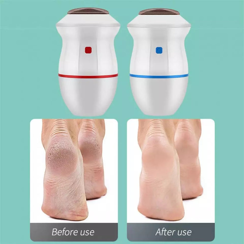 Rechargeable Foot Care Grinder Callus Remover